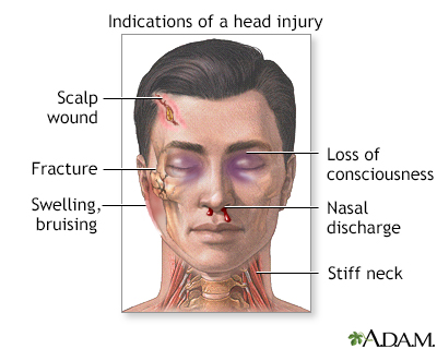 Head Injury First Aid